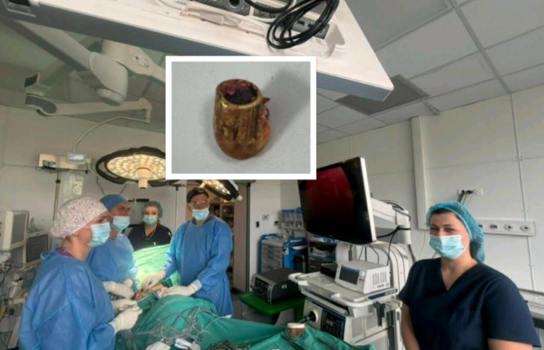 Në klinikën e Kirurgjisë Torakale në QKUK hiqet plumbi nga mushkëria e 28 vjeçarit